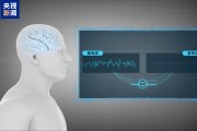 国家医保局为脑机接口医疗服务价格单独立项